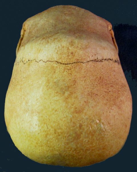 A Doco on the Pre Incas... Peruvian%20Giant%20Skull%203