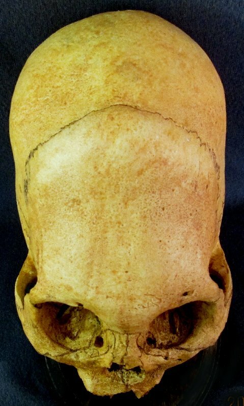 A Doco on the Pre Incas... Peruvian%20Giant%20Skull%204