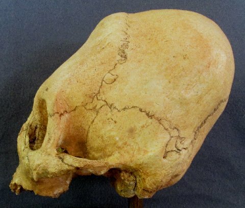 A Doco on the Pre Incas... Peruvian%20Giant%20Skull%205