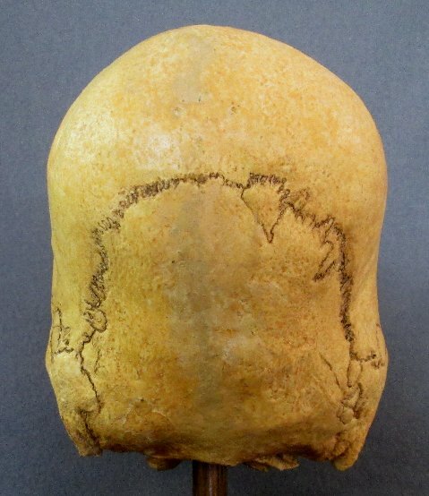 A Doco on the Pre Incas... Last%20pic%20of%20Peruvian%20skull